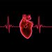 Carcinoid Heart Disease