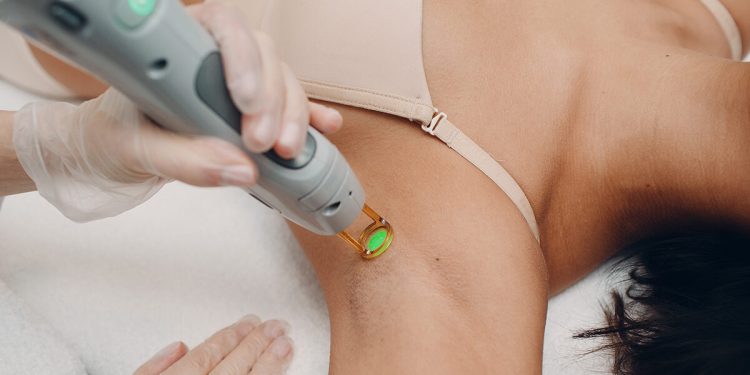 Sessions for Laser Hair Removal