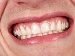 metlife dental