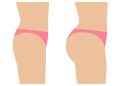 Female ass before and after plastic surgery. Concept of an increase in the buttocks. Vector illustration isolated on white, side view profile.