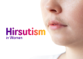 image with text as Hirsutism in women
